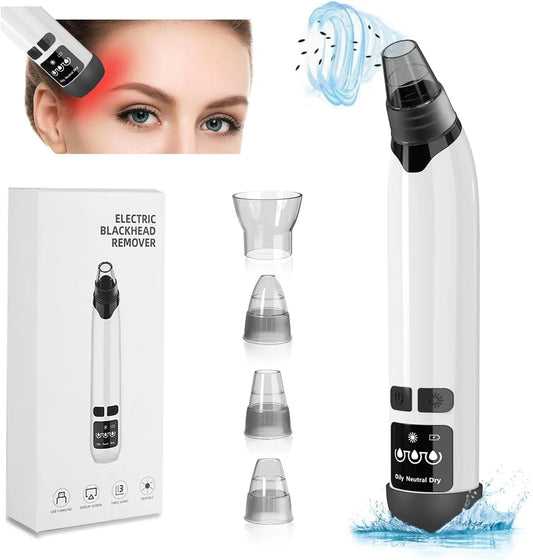 Pimple, Acne, Blackhead, Comedone Vacuum with Hot Compress
